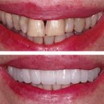 AF1QipNh3fQN64r8lgNeSD6CSrUTzFsponn8mNPYzpuBw408 h383 k no