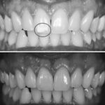 AF1QipOJLN6qetLz3LIimm96YnX4kxs8IsmRoPURoh8pw408 h421 k no